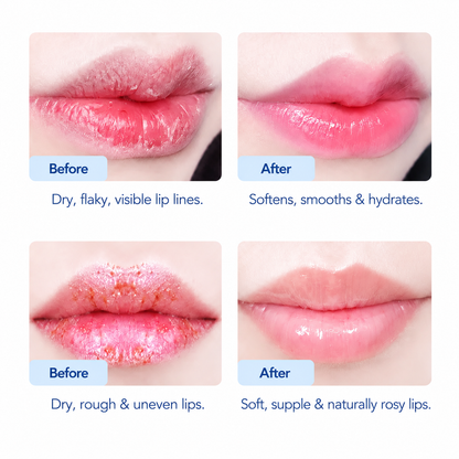 Joyivora✨Final Day of Promotion👄Lip Peel,Hydrating Lip Treatment Serum