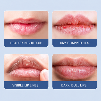 Joyivora✨Final Day of Promotion👄Lip Peel,Hydrating Lip Treatment Serum