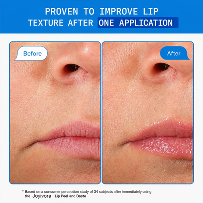 Joyivora✨Final Day of Promotion👄Lip Peel,Hydrating Lip Treatment Serum