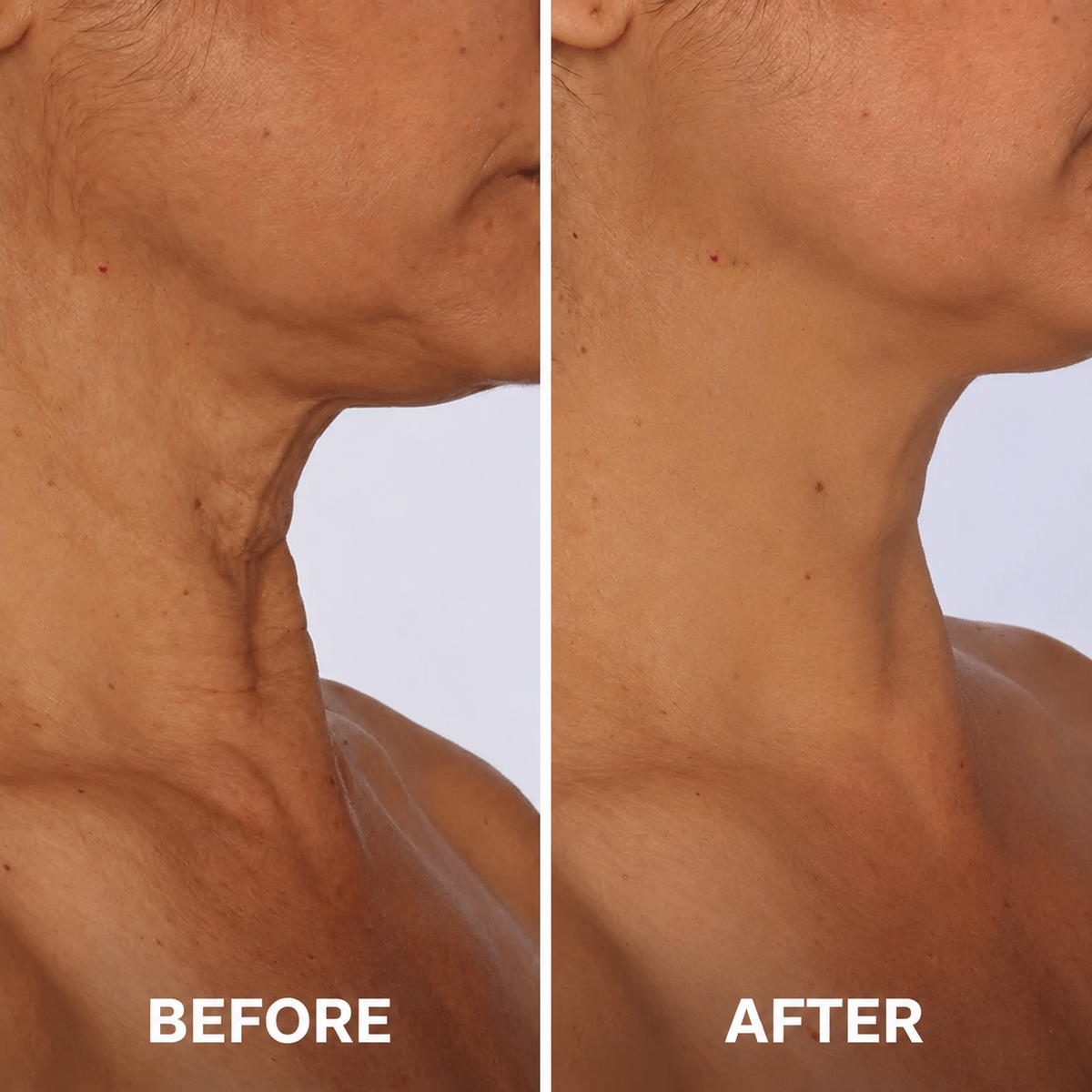 Last Day Buy 1 Get 1 Free✨Mirevyn💧Advanced Neck Firming Cream – Lift, Tighten & Restore Youthful-Looking Skin