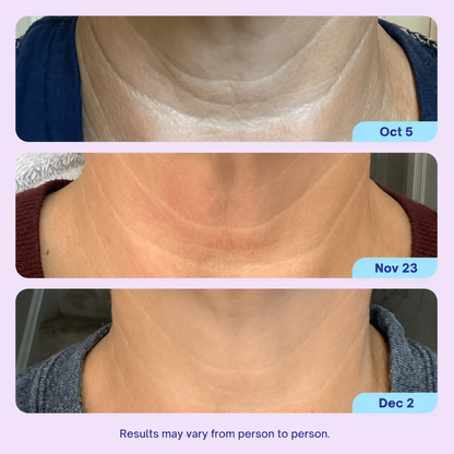 Last Day Buy 1 Get 1 Free✨Mirevyn💧Advanced Neck Firming Cream – Lift, Tighten & Restore Youthful-Looking Skin