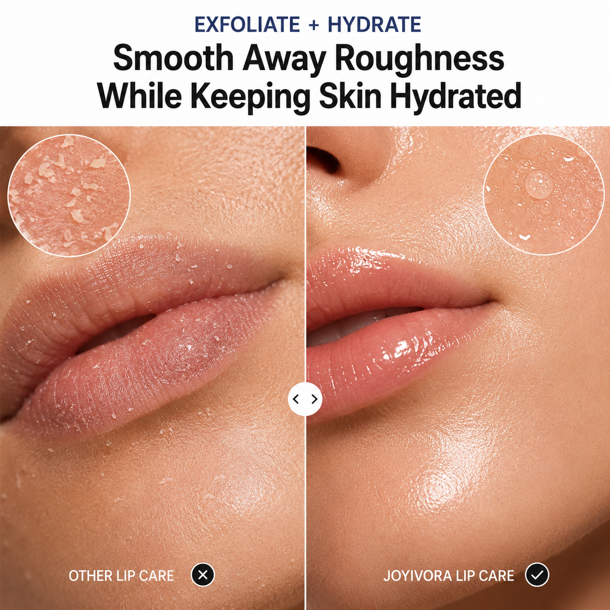 Joyivora✨Final Day of Promotion👄Lip Peel,Hydrating Lip Treatment Serum