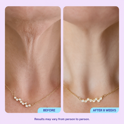Last Day Buy 1 Get 1 Free✨Mirevyn💧Advanced Neck Firming Cream – Lift, Tighten & Restore Youthful-Looking Skin